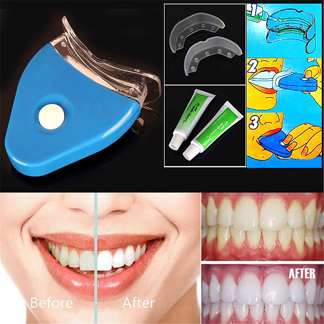 LED Teeth Whitening Kit with Oral Gel Fast Stain Removal